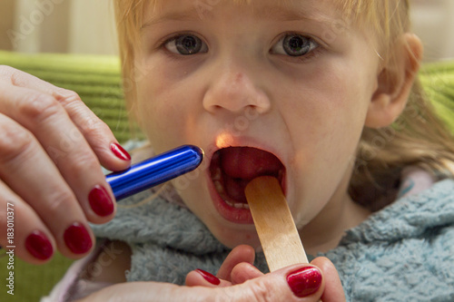 Scarlet fever. The pediatrician looks at a sick girl with a medical flashlight
