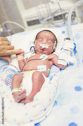 Mother touching her premature newborn baby as he is hooked up to an IV and health monitors while being treated in intensive care