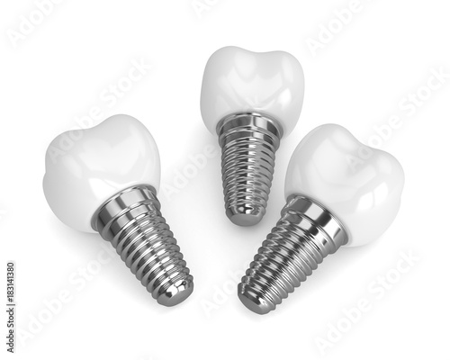 3d render of dental implants