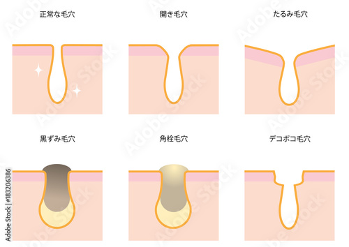 スキンケア　毛穴