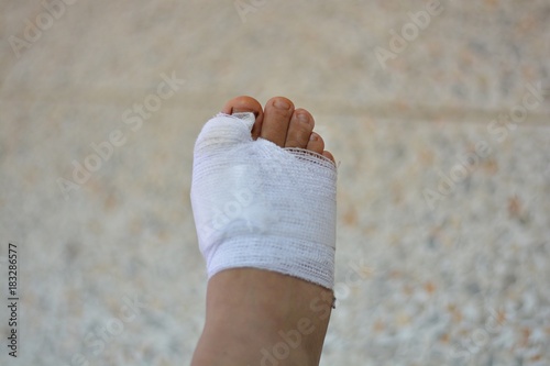 Foot ulcer background blurred/Foot ulcer Use cotton cloth to wrap the background blurred.