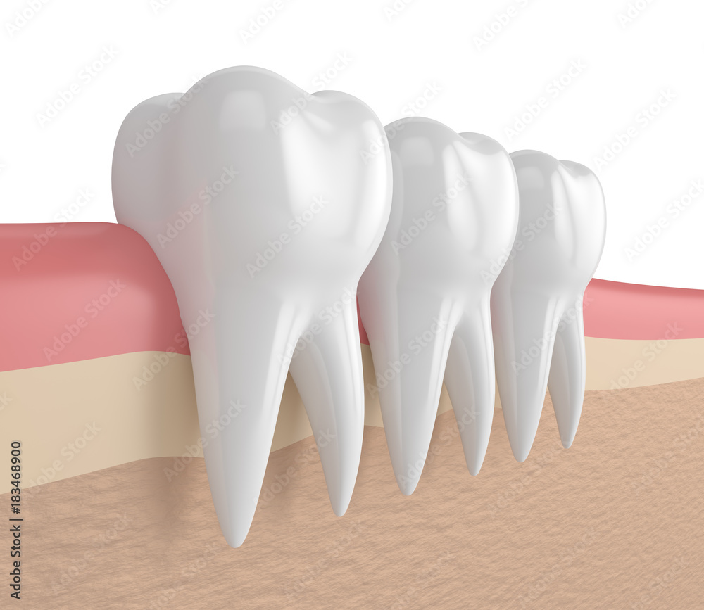 3d render of teeth in gums 3d render of teeth in gums