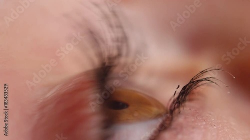 SLOW MOTION CLOSE UP: Brown eye flinches and blinks after large eye drop makes contact with irritated cornea. Detailed side view of woman applying eye drops to soothe dried up eye. Amber eye blinks. photo