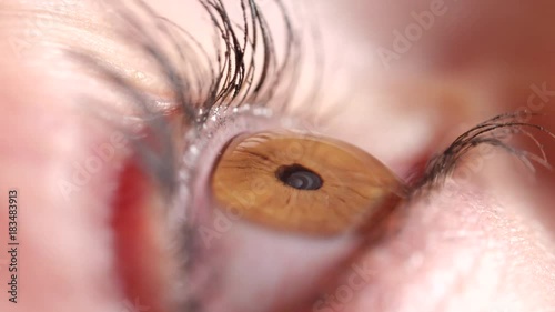 SLOW MOTION MACRO: Shiny clear brown eye twitches before application of eye drops to sooth irritation. Mascara covered lashes flinch when droplet hits eyeball. Female applying water drops to eyeball.