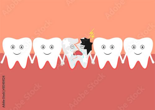 A number of teeth in the oral cavity, including one cracked tooth.
