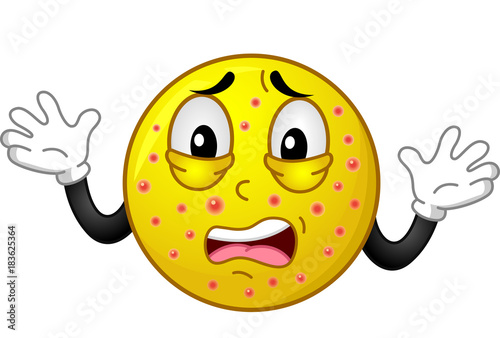 Mascot Smiley Chickenpox Illustration