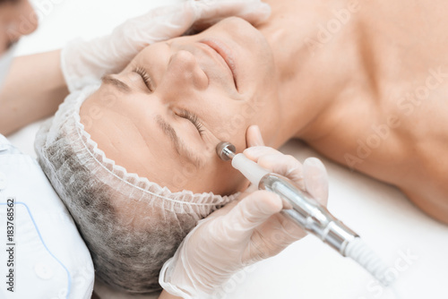 A man came to laser hair removal facial. Doctor leads him in the face with a modern laser epilator.