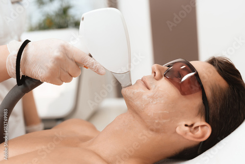 Cuadro en lienzo The doctor treats the face of a man with a modern laser epilator