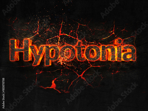 Hypotonia Fire text flame burning hot lava explosion background.