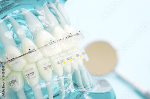 Wallpaper Mural orthodontic model and dentist tool - demonstration teeth model of varities of orthodontic bracket or brace Torontodigital.ca