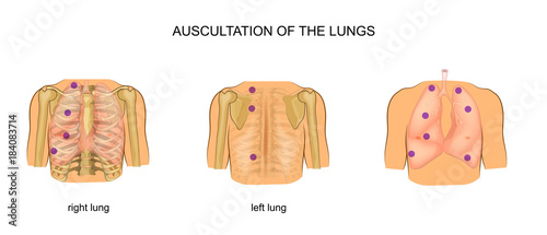 auscultation of the lungs photo