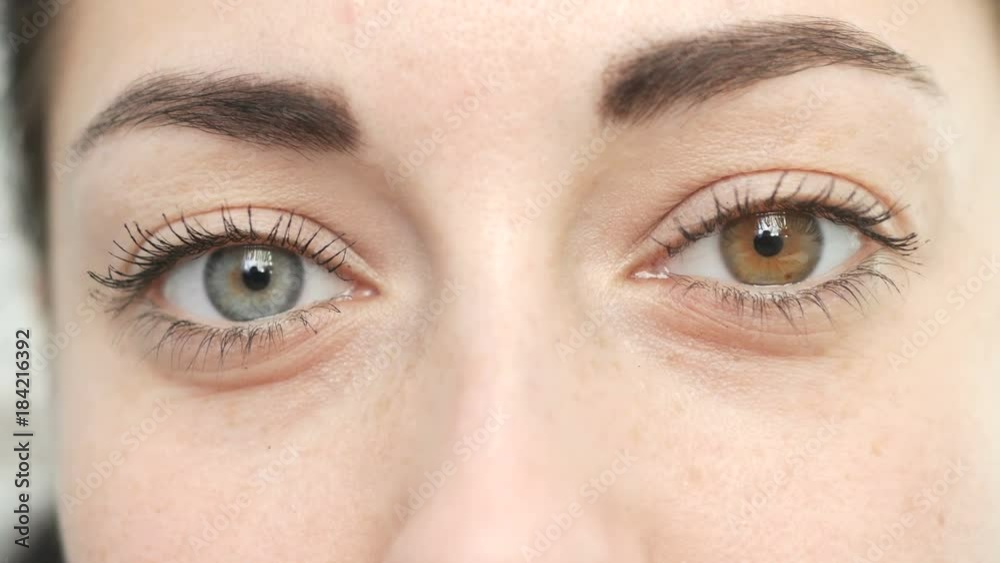 girl with different eyes looks at the camera, heterochromia, close-up girl with different eyes looks at the camera, heterochromia, close-up