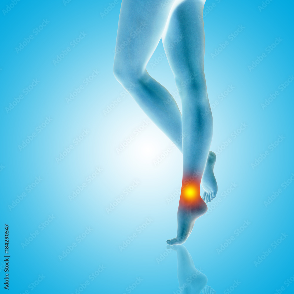 Conceptual beautiful woman or girl legs and feet with a hurt ankle pain or ache closeup, 3D illustration of human slim fit body medical or health care concept, painful sport injury on blue background