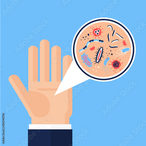 flat hand germs