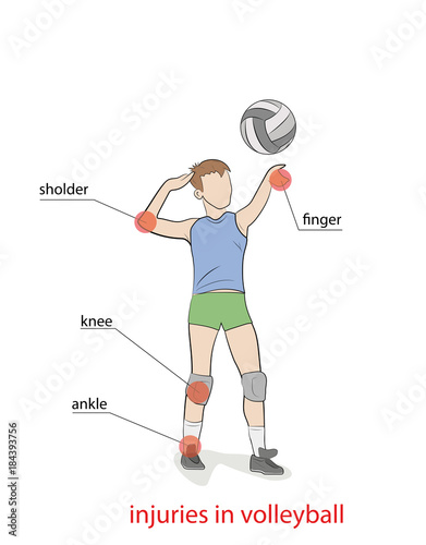 injuries in volleyball. the picture shows the most injured parts of the body when playing volleyball. vector illustration.