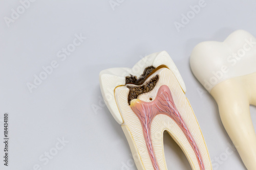  Tooth model for classroom education and in laboratory. photo
