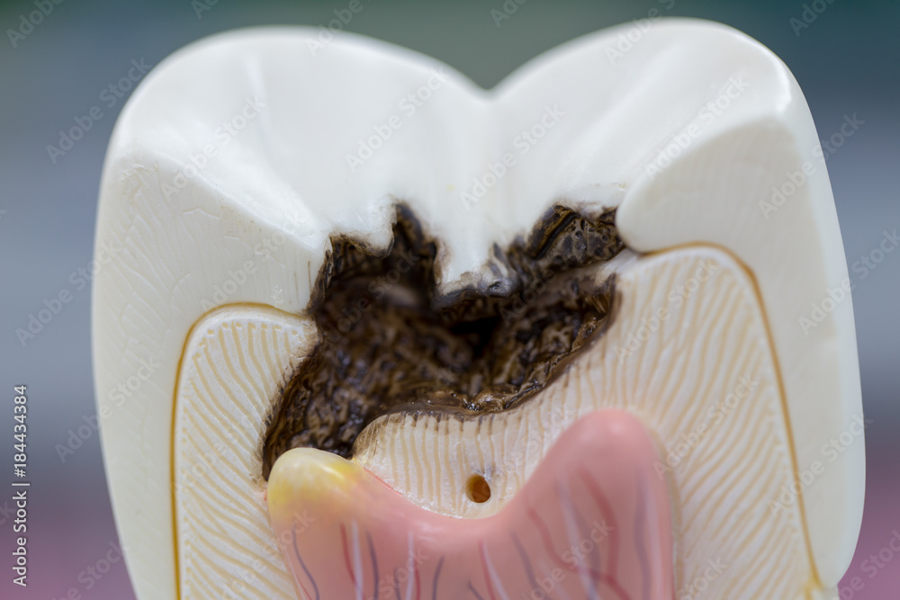 Fotografie Tooth model for classroom education and in laboratory.