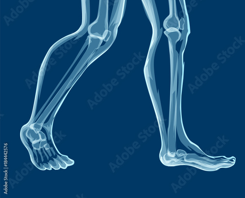 Human leg bones, x-rays. Mecial vector illustration. © enotmutant