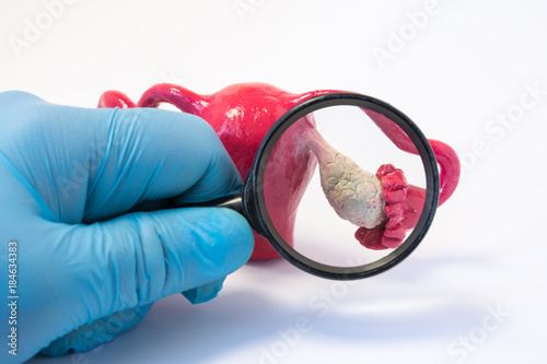 Search disease, abnormalities or pathology of ovary concept photo. Doctor holding magnifying glass and examines model of ovaries, conducting diagnostics for disease like cancer, apoplexy, cyst, POS photo