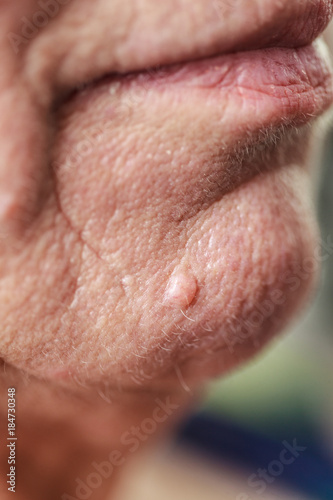 Elderly pensioner female, chin and lips closeup.