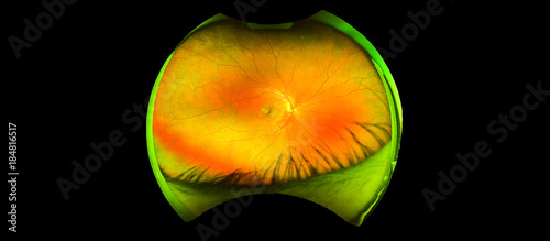 Fotografi eye's retinal angle image with macula, vessels and optic disc isolated view on a black bacground