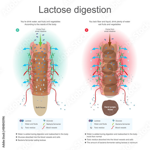 Lactose digestion.