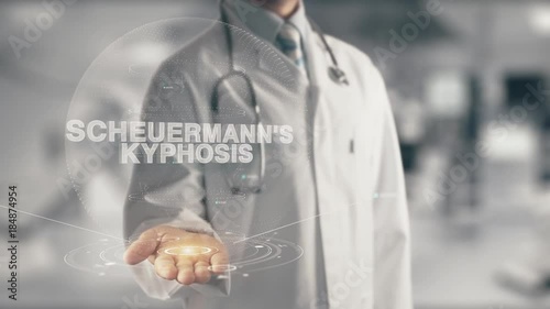 Doctor holding in hand Scheuermann's Kyphosis photo