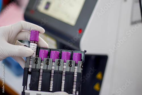 Scientists tested with automated hematology analysis in laboratory