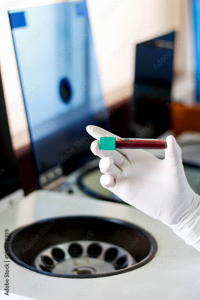 Hand holding test tube with blood plasma ready for testing in laboratory