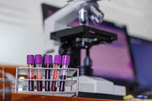 The blood in EDTA tube for test complete Blood Count (cbc)