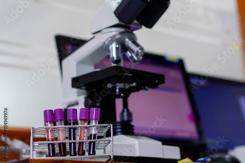 The blood in EDTA tube for test complete Blood Count (cbc)