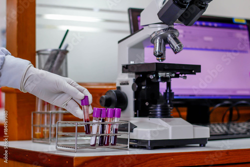 The blood in EDTA tube for test complete Blood Count (cbc)