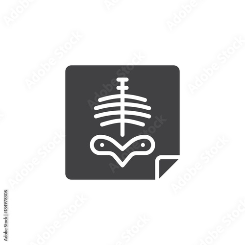 X-ray of human body chest icon vector, filled flat sign, solid pictogram isolated on white. Symbol, logo illustration
