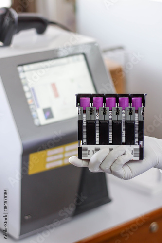 Scientists tested with automated hematology analysis in laboratory