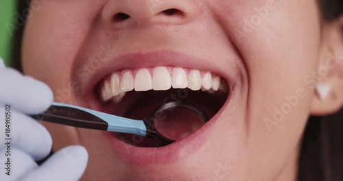 Hispanic girl smiling while getting her teeth checked on green screen. On green screen to be keyed or composited. 