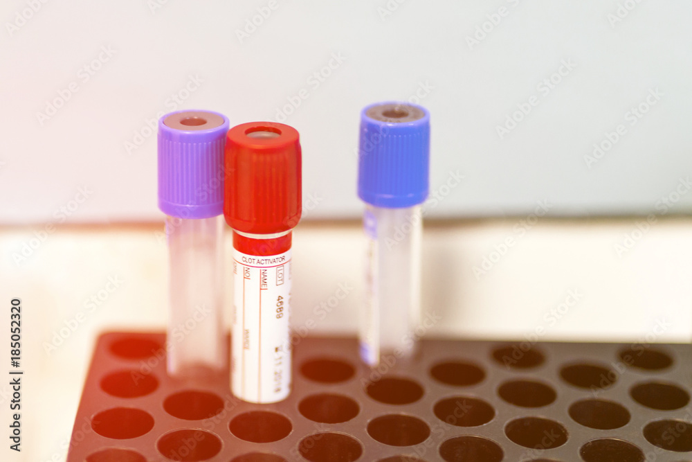Lot of empty laboratory blood analysis tubes at medical center Lot of empty laboratory blood analysis tubes at medical center