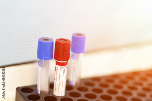 Lot of empty laboratory blood analysis tubes at medical center