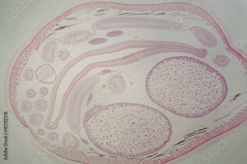 Parasitic nematode worm (Ascaris sp.) under the microscope