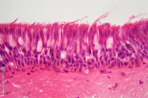 Ciliated epithelium under the microscope.