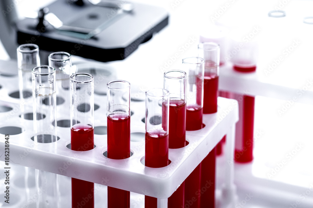 Medical equipment blood test in laboratory no one