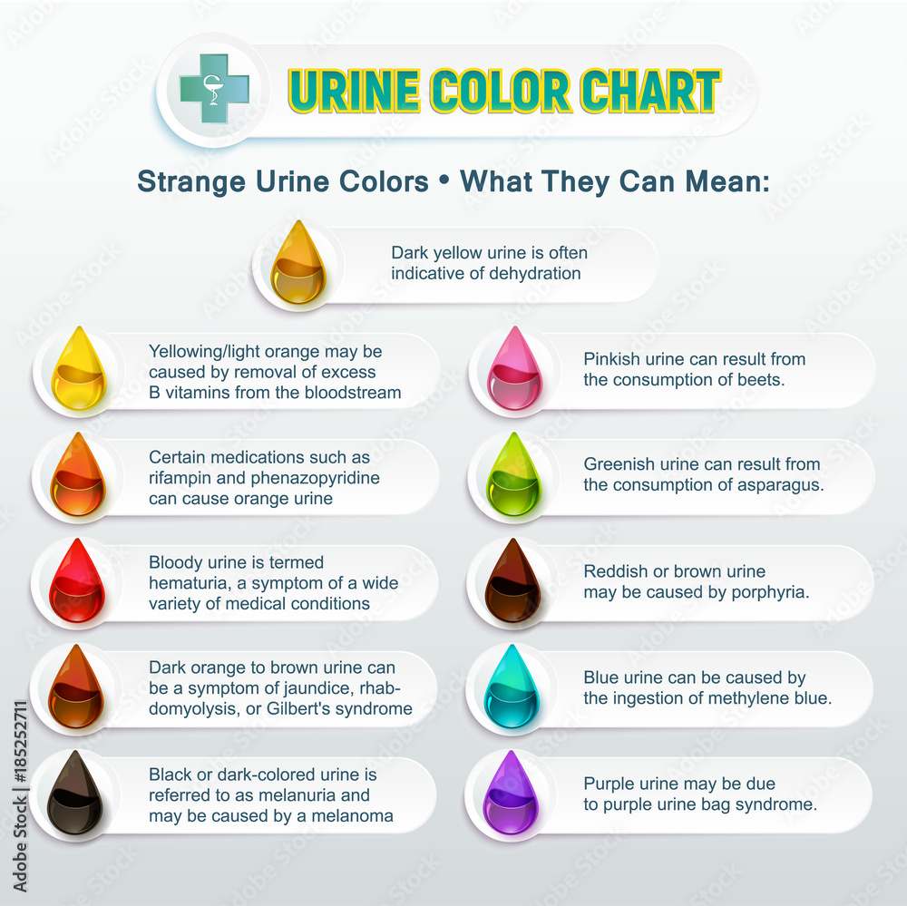 Urine Color Chart 2 Stock Vector Adobe Stock