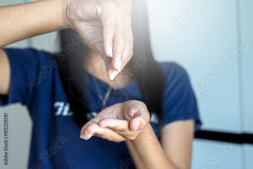 Hair loss on hand problem for health care concept