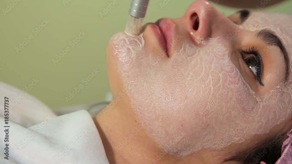 The young woman's face during the procedure closeup. Innovative cosmetic procedure. Medical procedure rejuvenation. Electrical dermapen The young woman's face during the procedure closeup. Innovative cosmetic procedure. Medical procedure rejuvenation. Electrical dermapen