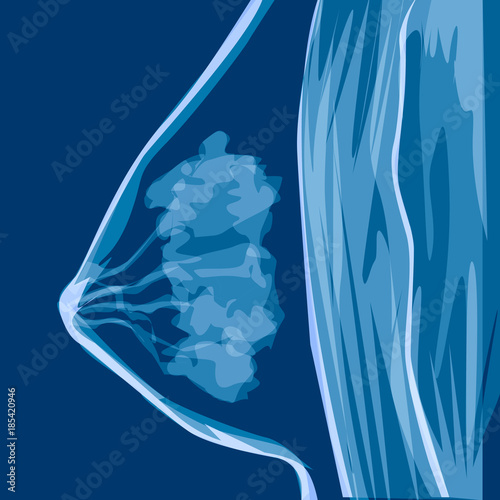 Woman Breast Anatomy. Vector medicine illustration, x-rays