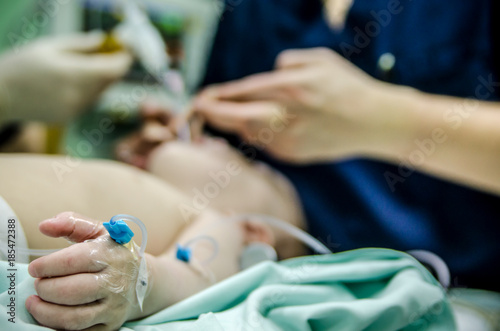 Peripheral catheter on a small patient's hand before a cardiac operation. In the background, the anesthetist and assistant fix the intubation tube.