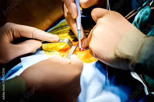 The cardiosurgeon performs a cut for lateral access to the heart with an electron-knife.