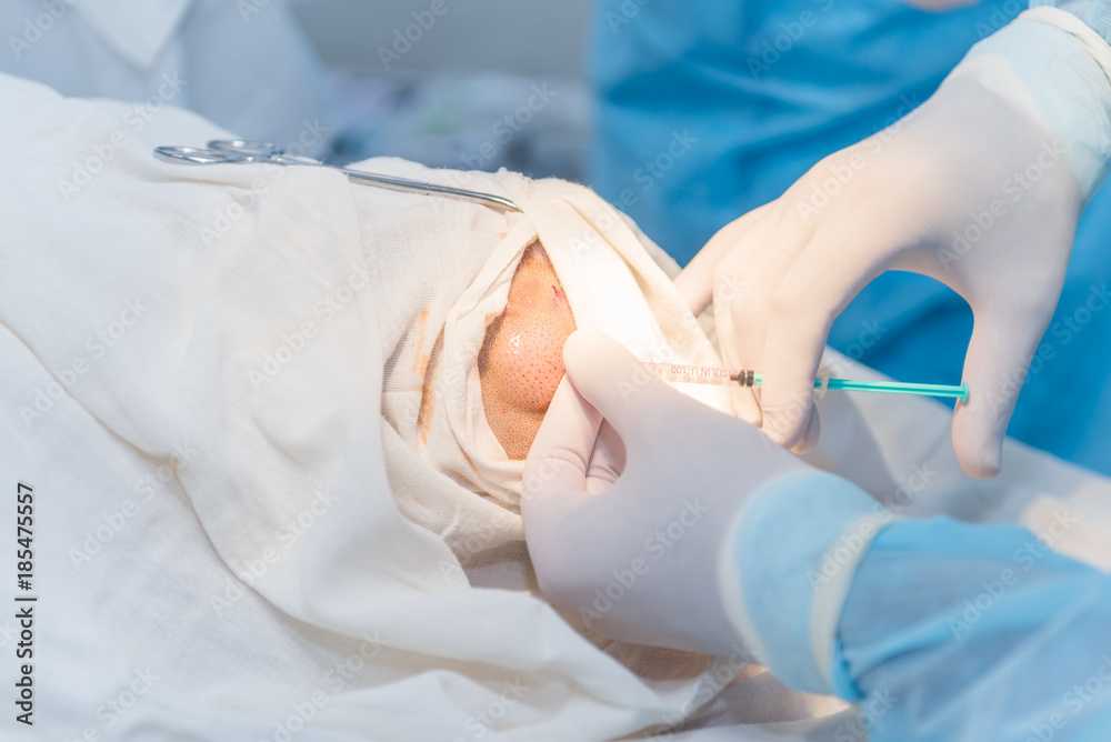 Fototapeta premium hands of an anesthesiologist with a syringe, anesthetizing the patient