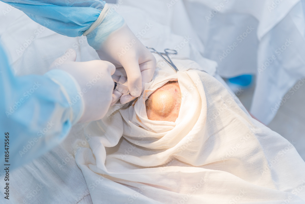 Fototapeta premium hands of an anesthesiologist with a syringe, anesthetizing the patient