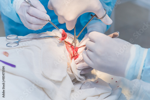 the hands of a surgeon's doctor doing operations on a remote atheroma on the patient's head in a hospital