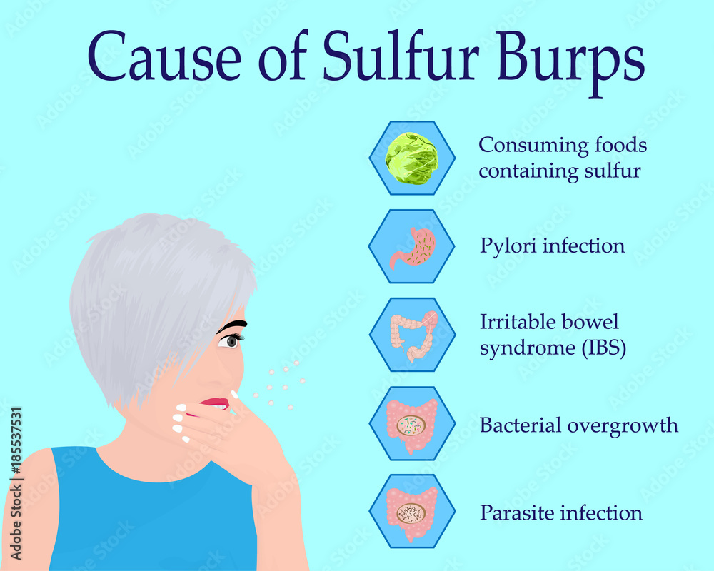 Fototapeta premium Causes of Sulfur Burps